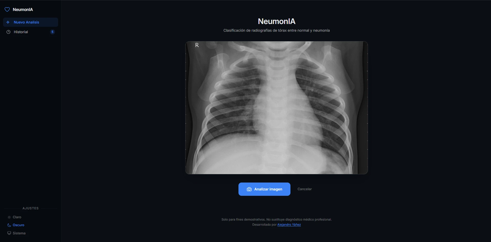 NeumonIA — screenshot 2