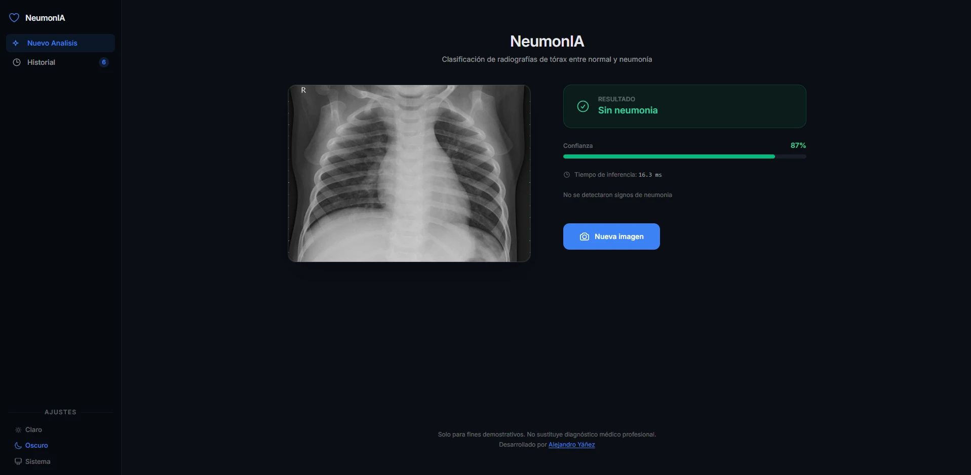 NeumonIA — screenshot 3