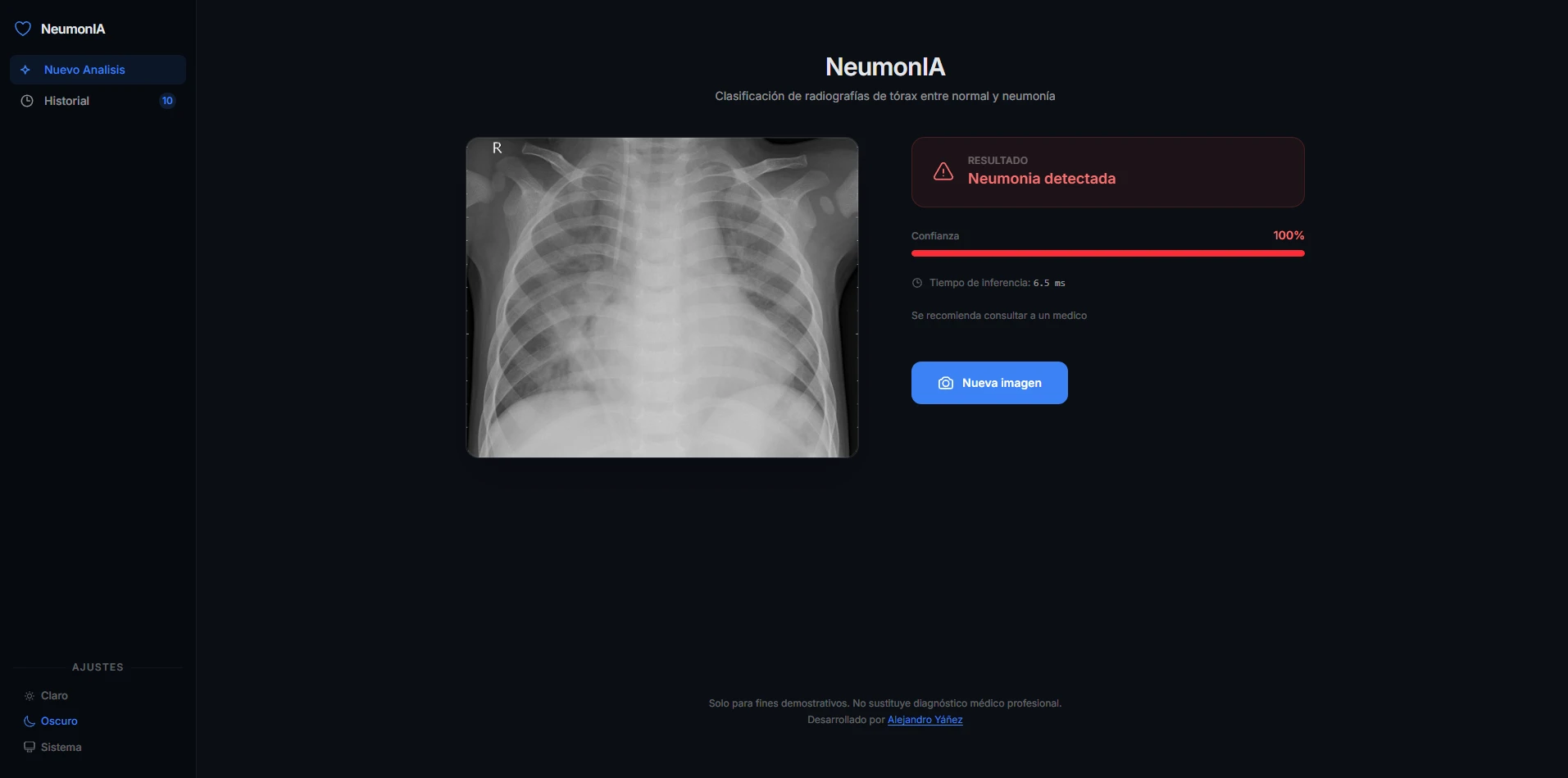 NeumonIA — screenshot 4